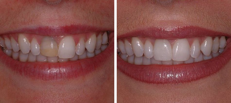 Dr. Tempel's Before + After